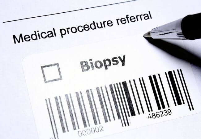 Request for Biopsy